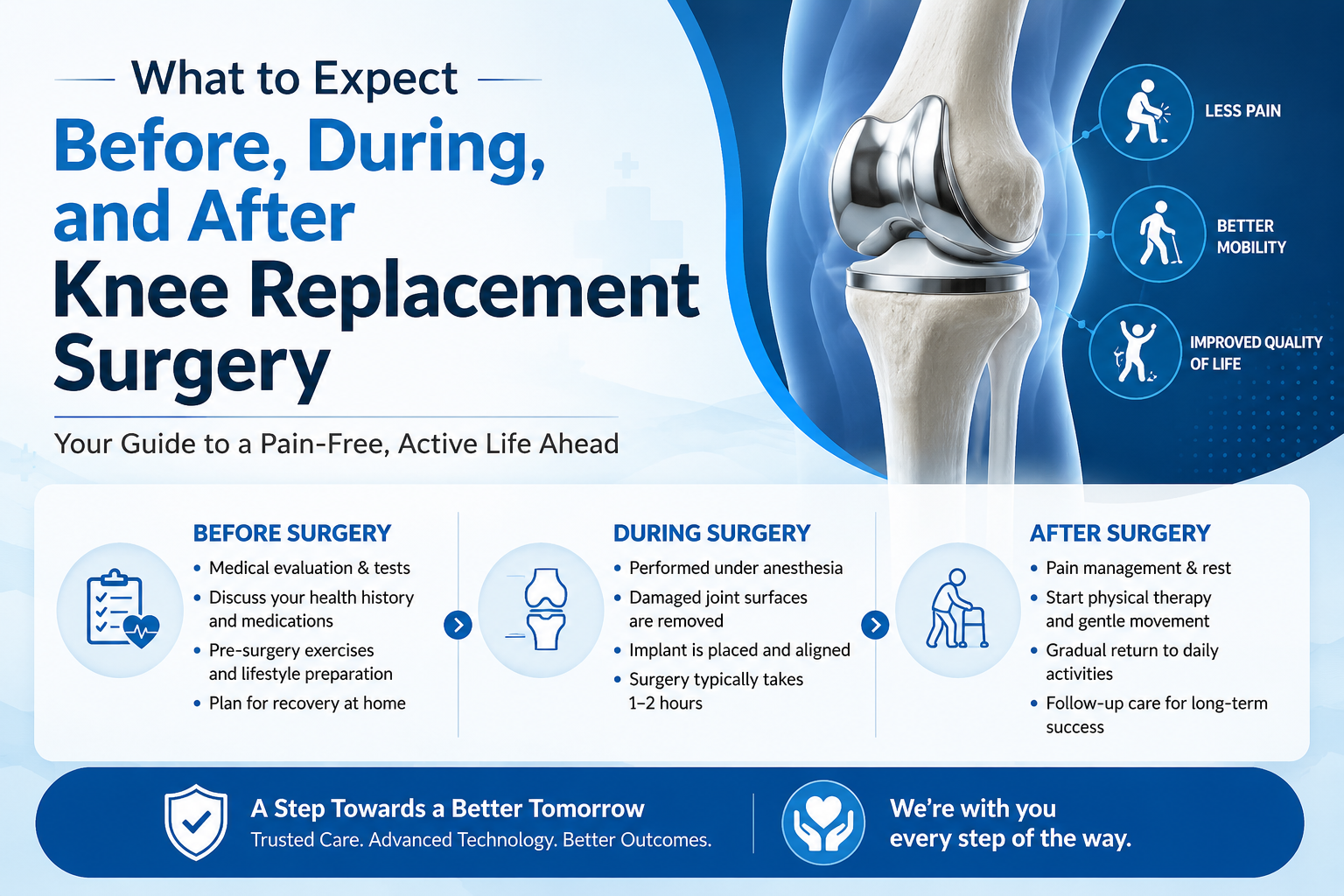 What to Expect Before, During, and After Knee Replacement Surgery